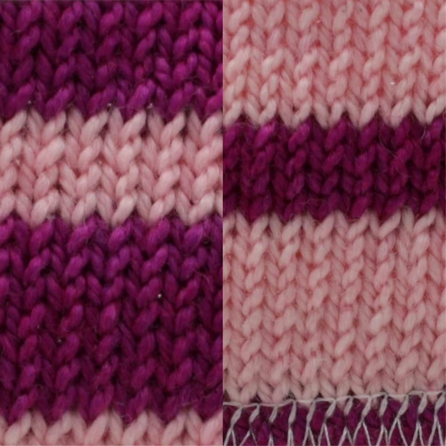 Phosphoglucomutase Sock Set